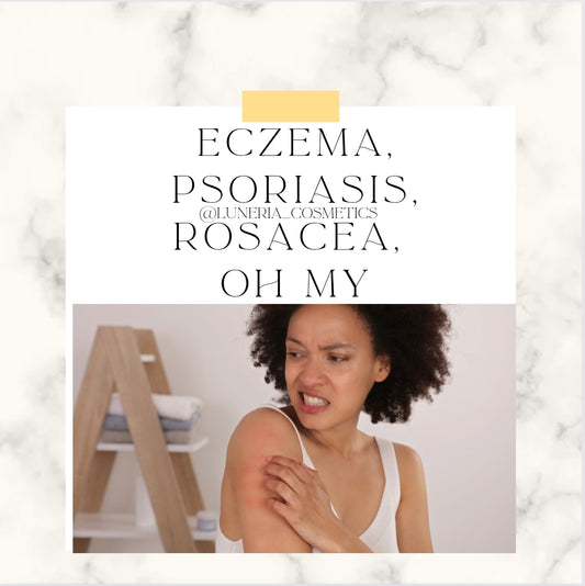 Eczema vs Psoriasis vs Rosacea: What are the similarities and differences? - Luneria Beauty Botanica